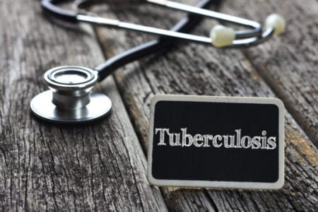 Reportan Tuberculosis activa en el Distrito Escolar Primario de Chula Vista