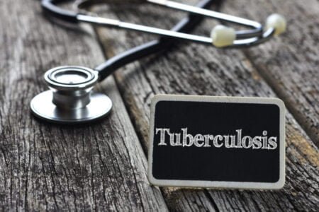 Hasta 175 mil ciudadanos de San Diego podrían tener tuberculosis